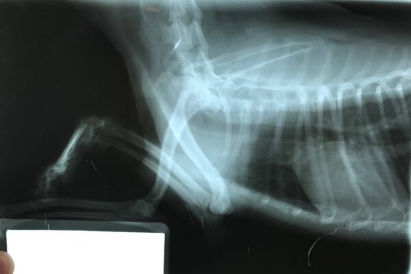radiografia torax